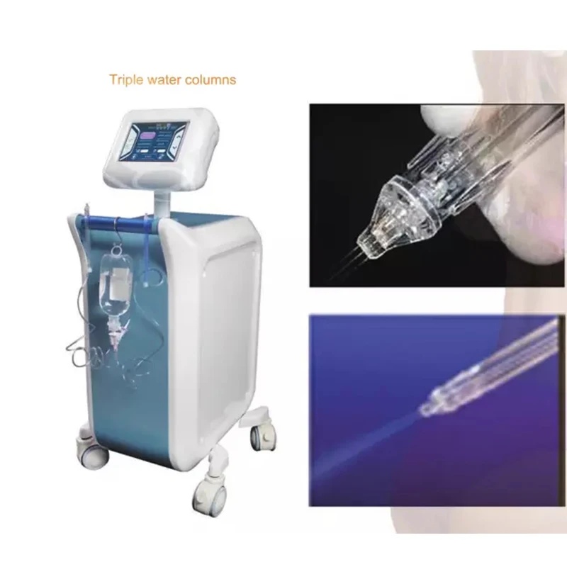 2025 Israel Tech Vertikale Hoc – Jet Tech Accessories Bewertung und Preis